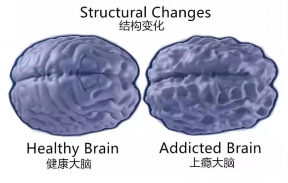 游戏成瘾改变大脑结构-戒游戏网